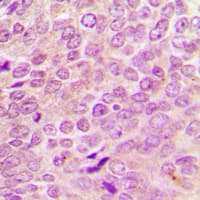 NF2 / Merlin Antibody (aa506-545)