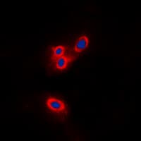 NF2 / Merlin Antibody (aa506-545)
