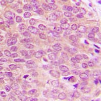 Polyclonal Rabbit anti-Human PBK / TOPK Antibody (N-Terminus, IHC, WB)