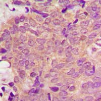 Polyclonal Rabbit anti-Human PPT1 / CLN1 Antibody (N-Terminus, IHC, WB)