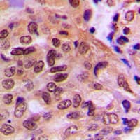 PTEN Antibody (C-Terminus)