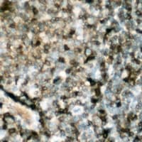 Polyclonal Rabbit anti-Human PTPN6 / SHP1 Antibody (C-Terminus, IHC, WB)