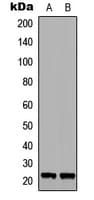 Polyclonal Rabbit anti-Human RAB6A / RAB6 Antibody (Internal, IHC, WB)