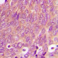 Polyclonal Rabbit anti-Human RAB6A / RAB6 Antibody (Internal, IHC, WB)