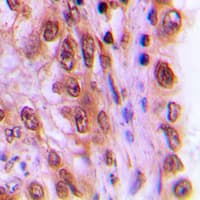 Polyclonal Rabbit anti-Human REL / C-Rel Antibody (C-Terminus, IHC, WB)