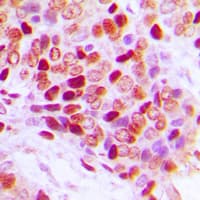 Polyclonal Rabbit anti-Human SF1 Antibody (N-Terminus, IHC, IF, WB)
