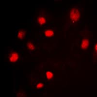 Polyclonal Rabbit anti-Human SF1 Antibody (N-Terminus, IHC, IF, WB)