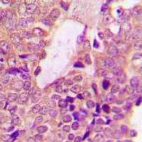 Polyclonal Rabbit anti-Human STAT2 Antibody (C-Terminus, IHC, WB)