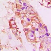 STMN1 / Stathmin / LAG Antibody (N-Terminus)