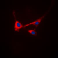 STMN1 / Stathmin / LAG Antibody (N-Terminus)