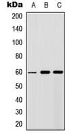 Polyclonal Rabbit anti-Human AKT1 + AKT2 + AKT3 Antibody (Internal, IHC, WB)