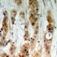 Polyclonal Rabbit anti-Human AKT1 + AKT2 + AKT3 Antibody (Internal, IHC, WB)