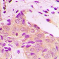 Polyclonal Rabbit anti-Human ETK / BMX Antibody (N-Terminus, IHC, IF, WB)