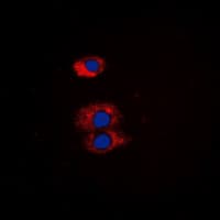 Polyclonal Rabbit anti-Human ETK / BMX Antibody (N-Terminus, IHC, IF, WB)