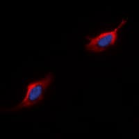 Polyclonal Rabbit anti-Human C5AR1 / CD88 / C5a Receptor Antibody (C-Terminus, IHC, IF, WB)