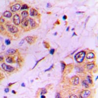 Polyclonal Rabbit anti-Human CDC25A Antibody (phospho-Ser178, IHC, WB)