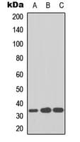 Polyclonal Rabbit anti-Human CDK1 / CDC2 Antibody (Internal, WB)