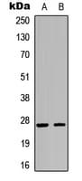 Polyclonal Rabbit anti-Human CDKN1B / p27 Kip1 Antibody (C-Terminus, WB)