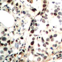 CHEK2 / CHK2 Antibody (N-Terminus)