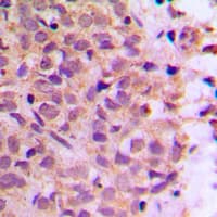 Polyclonal Rabbit anti-Human COPZ1 Antibody (N-Terminus, IHC, WB)