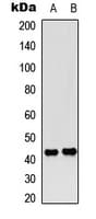 CREB1 / CREB Antibody (phospho-Ser142)