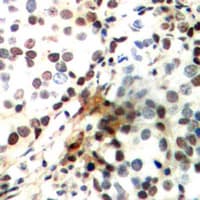 CREB1 / CREB Antibody (phospho-Ser142)