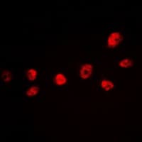 CREB1 / CREB Antibody (phospho-Ser142)