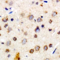 Polyclonal Rabbit anti-Human CRYAB / Alpha B Crystallin Antibody (N-Terminus, IHC, WB)