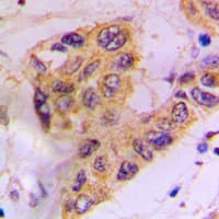Polyclonal Rabbit anti-Human CSNK1A1 / CK1 Alpha Antibody (C-Terminus, IHC, WB)