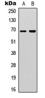 Polyclonal Rabbit anti-Human DDX5 Antibody (C-Terminus, IHC, IF, WB)