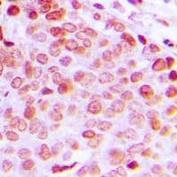Polyclonal Rabbit anti-Human DDX5 Antibody (C-Terminus, IHC, IF, WB)