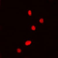 Polyclonal Rabbit anti-Human DDX5 Antibody (C-Terminus, IHC, IF, WB)