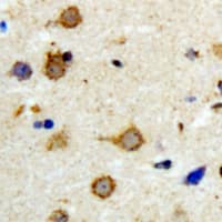Polyclonal Rabbit anti-Human DGKK Antibody (C-Terminus, IHC, IF, WB)