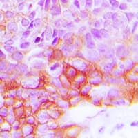Polyclonal Rabbit anti-Human EGFR Antibody (C-Terminus, IHC, WB)