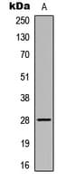 Polyclonal Rabbit anti-Human HELO1 / ELOVL5 Antibody (C-Terminus, IHC, WB)