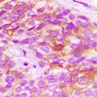 Polyclonal Rabbit anti-Human HELO1 / ELOVL5 Antibody (C-Terminus, IHC, WB)