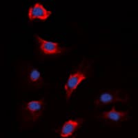 Polyclonal Rabbit anti-Human F13B / TGase Antibody (N-Terminus, IF, WB)