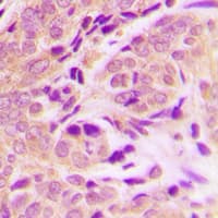 Polyclonal Rabbit anti-Human FADD Antibody (C-Terminus, IHC, WB)