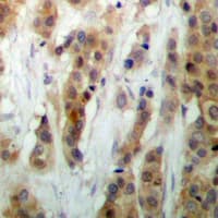 Polyclonal Rabbit anti-Human HEXIM1 Antibody (Internal, IHC, IF, WB)