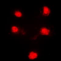 Polyclonal Rabbit anti-Human HEXIM1 Antibody (Internal, IHC, IF, WB)