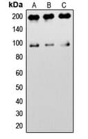 IGF1R / IGF1 Receptor Antibody (C-Terminus)