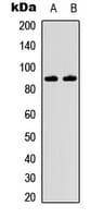 Polyclonal Rabbit anti-Human IKBKB / IKK2 / IKK Beta Antibody (Internal, IHC, WB)