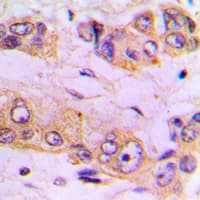 Polyclonal Rabbit anti-Human IKBKB / IKK2 / IKK Beta Antibody (Internal, IHC, WB)