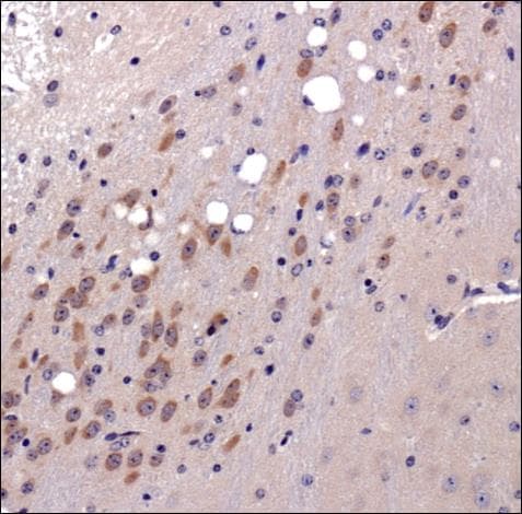 MMP3 Antibody (aa400-477)
