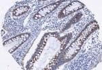 Polyclonal Rabbit anti-Human AGR2 Antibody (aa50-100, IHC)