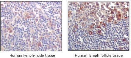 BTK Antibody (C-Terminus, clone 7F12H4)