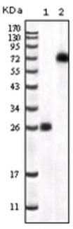 BTK Antibody (C-Terminus, clone 7F12H4)