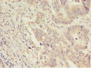 Polyclonal Rabbit anti-Human CNTFR Antibody (HRP, IHC, WB)