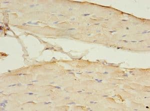 Polyclonal Rabbit anti-Human CNTFR Antibody (HRP, IHC, WB)