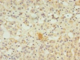 SERPINB8 Antibody